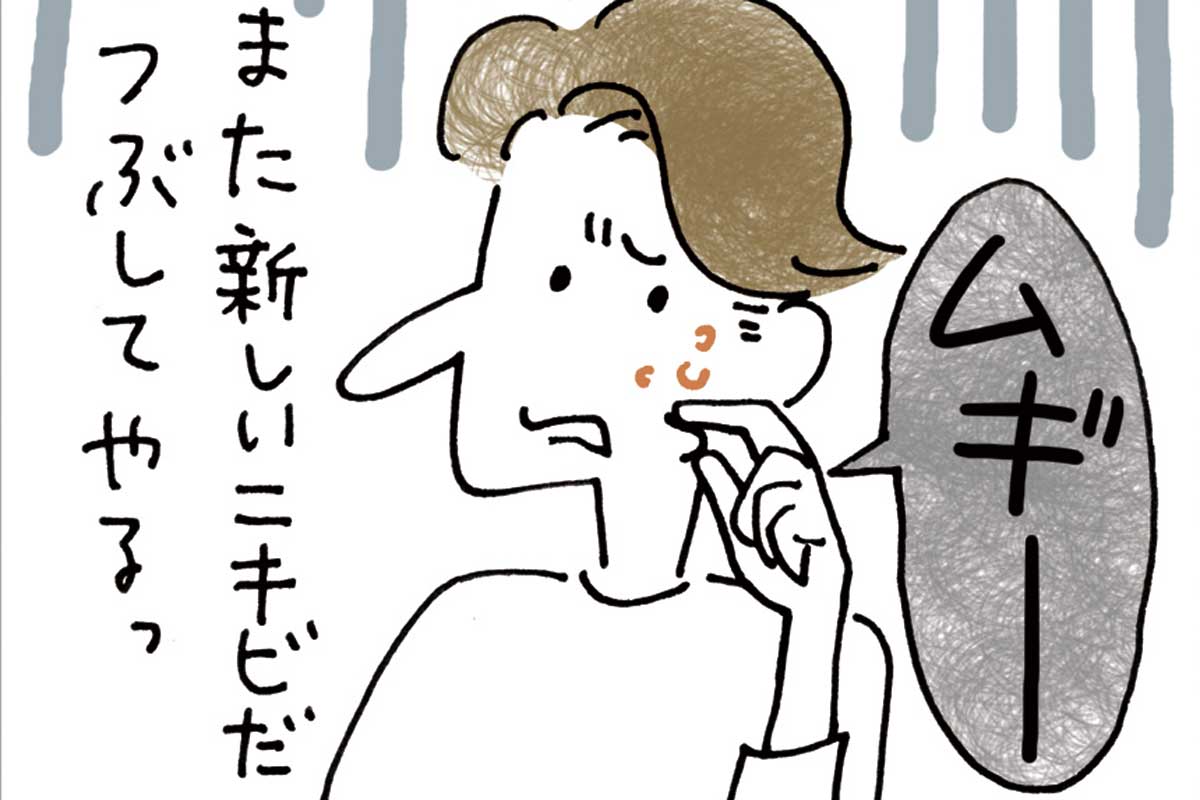 ニキビを治す方法とは ニキビの原因 治し方やおすすめの洗顔を紹介 ビューティ Fineboys Online